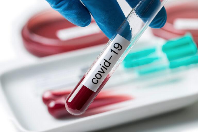 covid-19 medicinical sample testing laboratory background